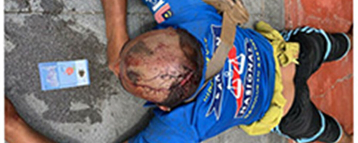 Aid for Mental Disorder