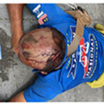 Aid for Mental Disorder